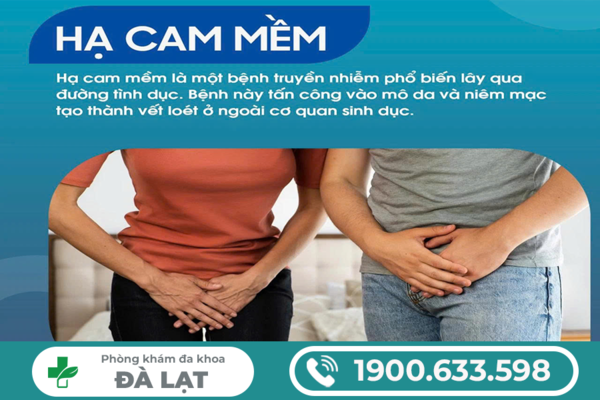 Hình ảnh minh họa